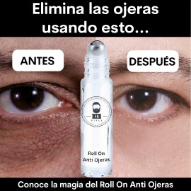 Roll On Anti Ojeras Oscuras Anti Bolsas Inflamadas Om Style