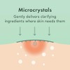 Rael Miracle Microcrystal Spot Cover - Hidrocoloide, parches de acné