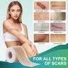 Gowgaw Medical Grade Silicone Scar Sheets, Silicone Scar Tape (1.6”x