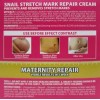 Total Supplier Crema Corporal Anti Estrias Previene Y Remueve Marcas