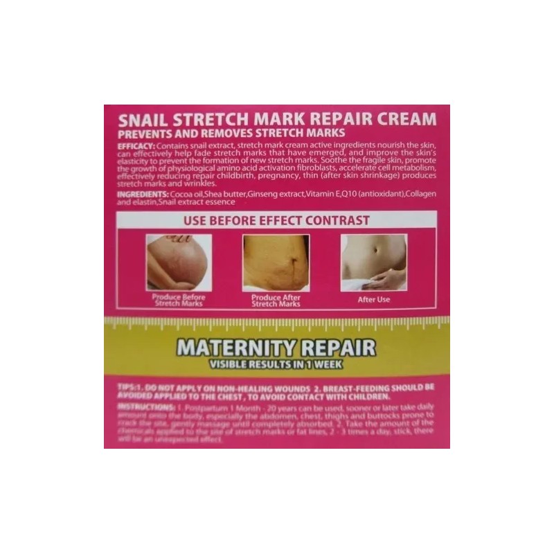 Total Supplier Crema Corporal Anti Estrias Previene Y Remueve Marcas