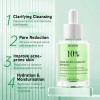 Serum Acido Azelaico 10 Y Hialurnico Piel Grasa Aclarante Grasa