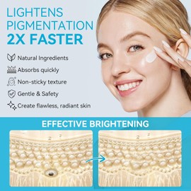 Dark Spot Remover for Face and Body – Brown Spots Corrector for Sun Spots, Age Spots, Freckles, Melasma–Moisturizes Face Cream for All Skin Type