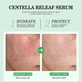 Centella Unscented Serum,Centella Serum,Facial Serum for face,Dark Spot Correcting Glow Serum,Korean Skin Care for Women,Dark Spot Remover for Face,Lightweight Hydrating Serum for All Skin Types