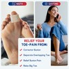 Toe Separator for Overlapping big Toes,Big Toe Spacers for Bunion,Toe