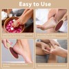 ACWOO Callus Remover, Callus Removal Foot, Double-Sided Foot File for