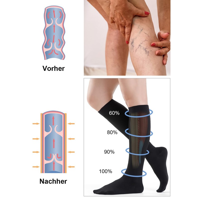 Medicale Calze Compressione Graduata Donna e Uomo 20-30mmHg Classe 2,