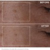 DOUBLE SERUM 30 ml