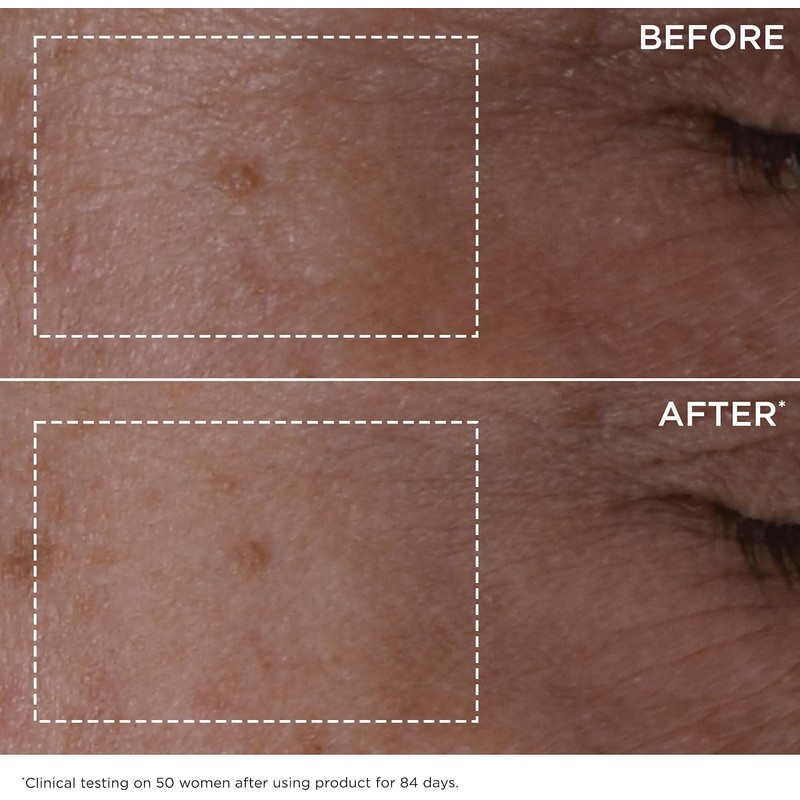 DOUBLE SERUM 30 ml