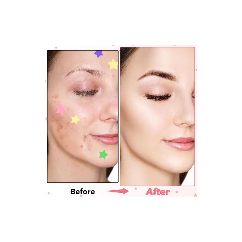 Estrellas Amarilla Para Acné Granos De Espinillas Patch 240p