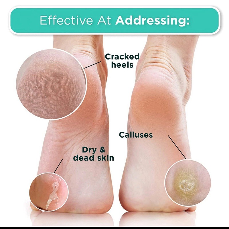 Dermora~Foot Peel Mask for Soft Smooth Feet~3 Pairs~W/Lavend