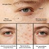 1pcs Crema Pore+dark Spot 35ml Piel Todo Todo Tipo De