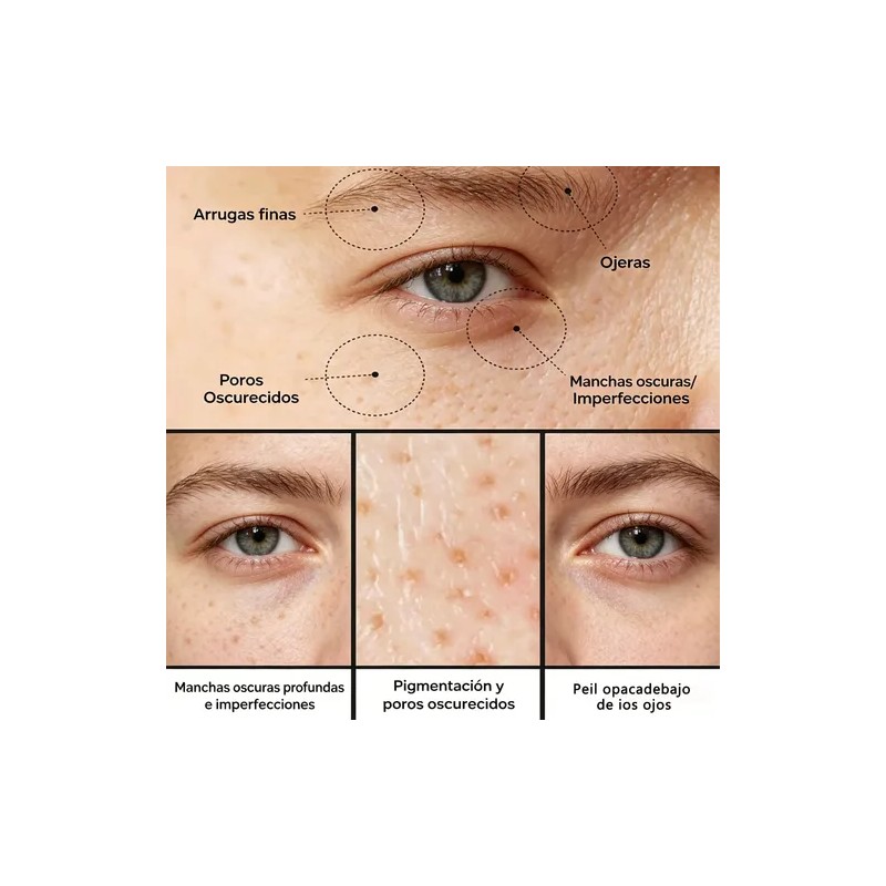 1pcs Crema Pore+dark Spot 35ml Piel Todo Todo Tipo De