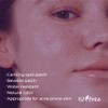 ISNTREE Parches para Imperfecciones Onion Newpair Spot Patch Basic -