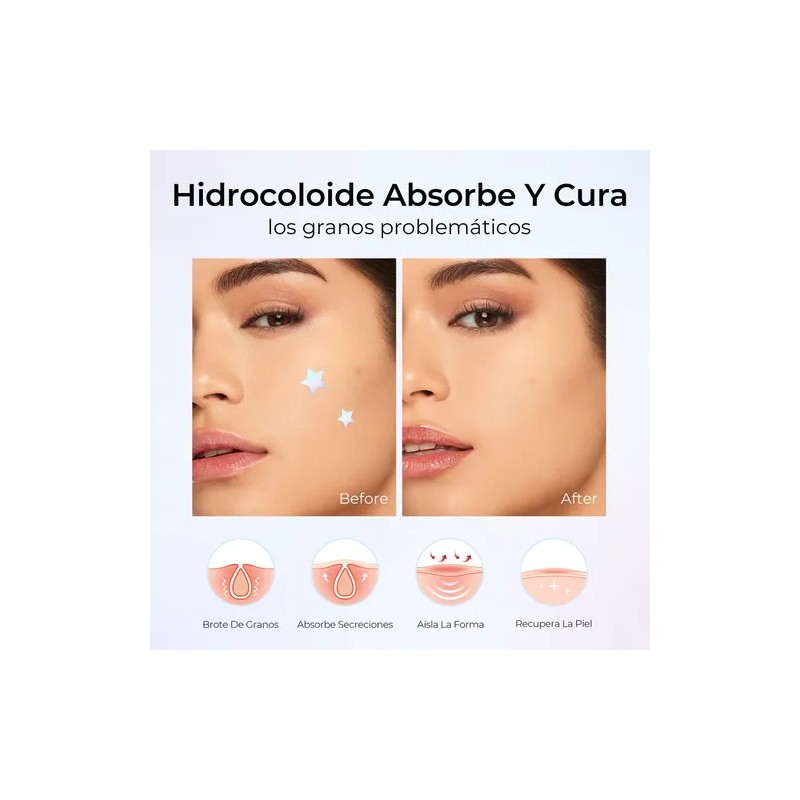 Sace Lady 45pzs Parches Pegatinas Para Acné Absorbentes Pimp Normal