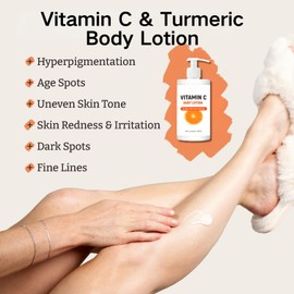 IZBEAUVO Vitamin C & Turmeric Body Lotion,Turmeric Moisturizer Vitamin c Body Cream,Brightening Body Lotion,Moisturizing Body Lotion for Dry Skin, Remove Dark Spots Large-capacity 150ml