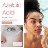 Polvo Ácido Azelaico Onzas 113 Gramos Fino Hacer Crema Gel