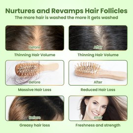 Rosemary Shampoo for Hair Growth: Thickening & Regrowth Formula for Women & Men - Rosemary Mint Strengthening Shampoo with Tea Tree Oil Biotin for Thinning & Loss Hair & Dry Damaged Care