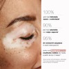 BELLA AURORA Repigment SunScreen SPF 30 75ml Sunscreen for Pigment