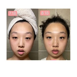 Jade Roller for Face and Gua Sha Set, Jade Roller, Gua Sha Massage Set, Face Roller for Eye Puffiness Treatment, Skin Tightening, Rejuvenate Face & Neck, Natural Green Slimming Massager (Roller-1)