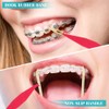 30 bandas elásticas dentales multicolor para tirantes, de plástico, desechables,
