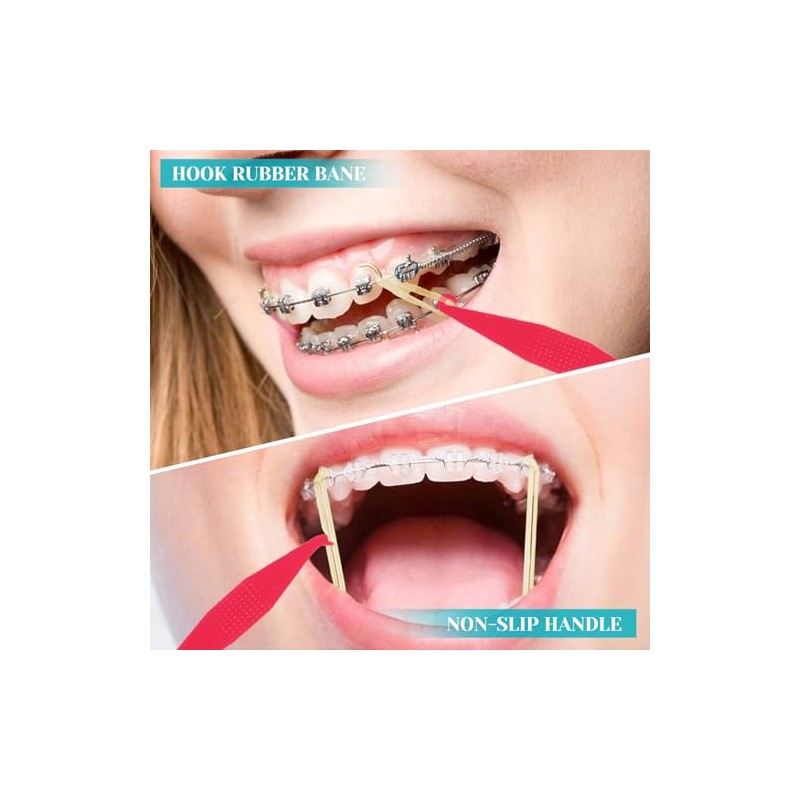 30 bandas elásticas dentales multicolor para tirantes, de plástico, desechables,