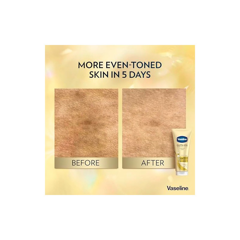 Vaseline Gluta-Hya Flawless Tone Serum Burst Lotion 200 ml