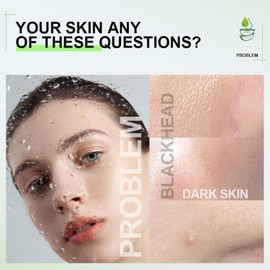 Gel de aloe vera puro, gel hidratante natural de aloe vera, hidratante diario para el rostro, el cabello y el cuerpo, calmante y nutritivo, cuidado después del sol, 200 g