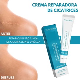 Crema Manchas Despigmentante Melasma Acné Paño Cicatrices