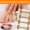 Pack of 40 Toenail Correction Patches, Ingrown Toenails, Nail Correction