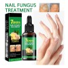 Lápiz Líquido Reparador De Uñas, Tratamiento Para Hongos En