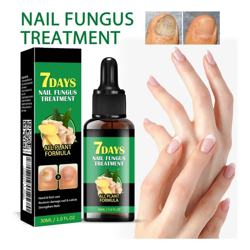 Lápiz Líquido Reparador De Uñas, Tratamiento Para Hongos En