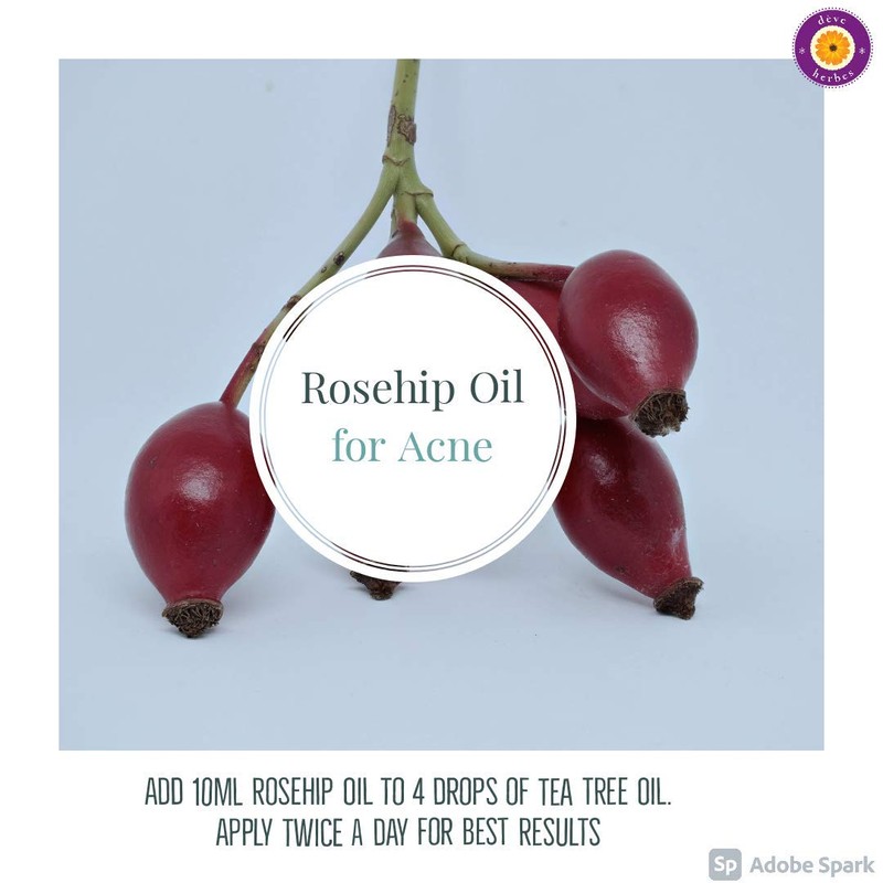 dève herbes Pure Rosehip Oil (Rosa rubiginosa) Cold Pressed 30ml