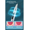 Electric Dental Calculus Remover 3 Modes LED IPX6 Waterproof Tartar