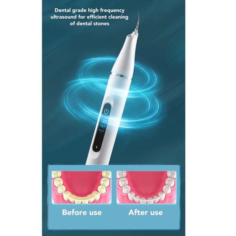 Electric Dental Calculus Remover 3 Modes LED IPX6 Waterproof Tartar