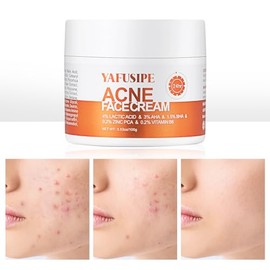 Acne Treatment for Face for Hormonal Cystic Stubborn Acne Cream for Sensitive Skin Teens Adults Women Men Spot Pimple Butt Control Rapid Clearing Brea