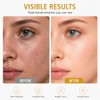 2PCS Firming Collagen Spray - Hydrating Moisturizer Mist