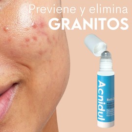 ACNIDUL | Roll-on immediate action with glycolic acid and calendula | Eliminate pimples from your face | 14 ml |