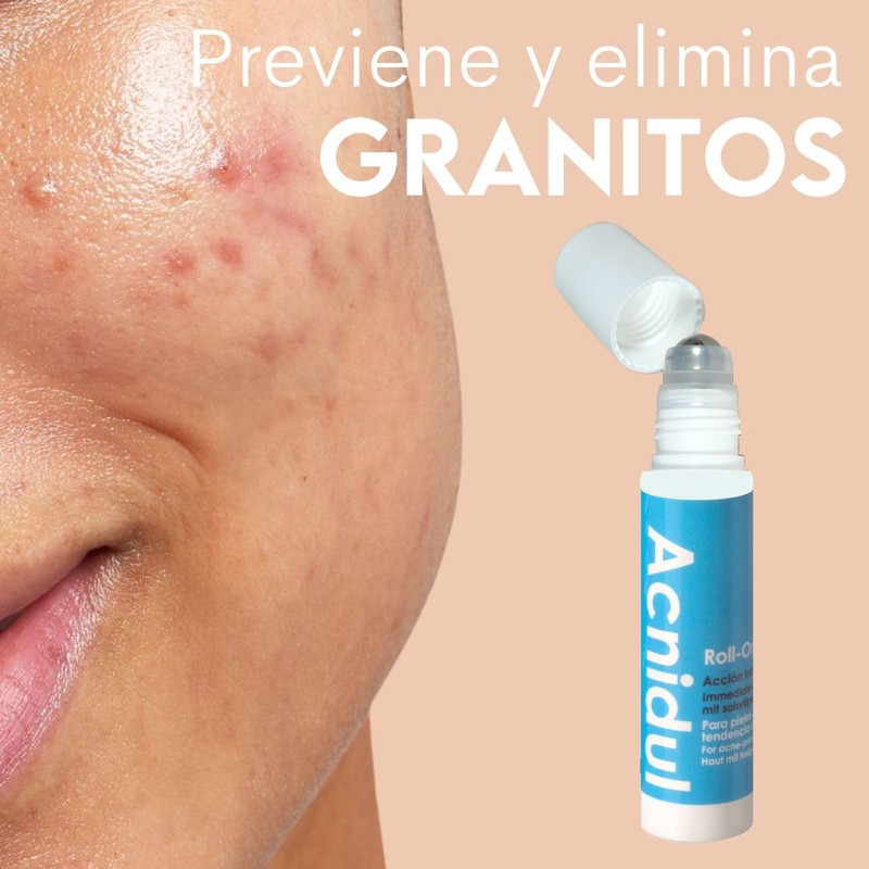 ACNIDUL | Roll-on immediate action with glycolic acid and calendula
