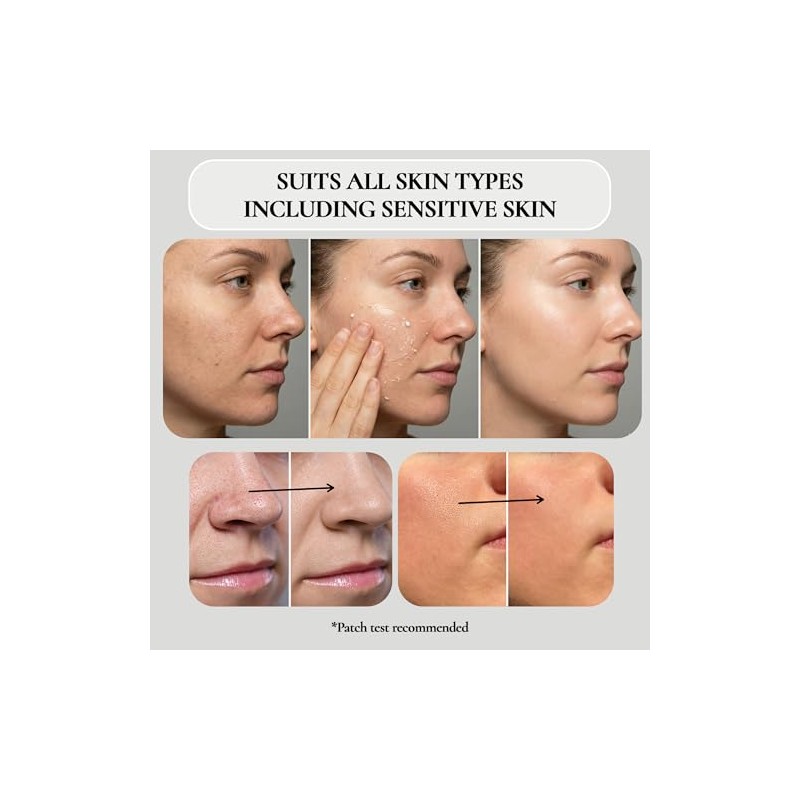 Vivo Per Lei Facial Peeling, 1.7-fluid Ounce by Vivo per