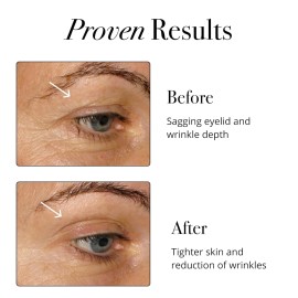 Unbranded Glotrition Super Beauty Elixir - Collagen Peptides Powder for Skin, Hair & Nail