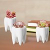 YOFIT Modern Style Teeth Pots Ceramic Flower Pot, White Succulent