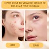 16 piezas – Kit de herramientas para eliminar espinillas y