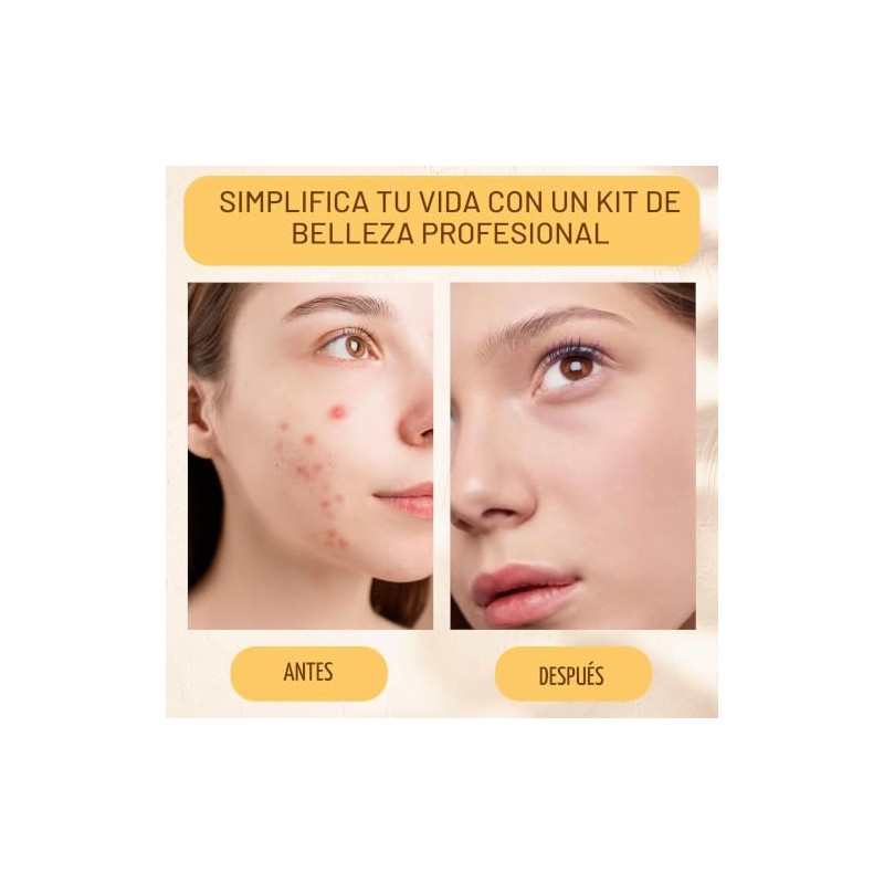 16 piezas – Kit de herramientas para eliminar espinillas y
