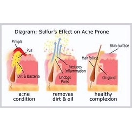 JOESOEF SKIN CARE JOESOEF SKIN CARE Sulfur Soap Acne Facial Cleanser Anti Acne Sulfur Soap 100G 4 Pack