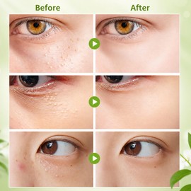 Vitamin E Milia Cream - Milia Daily Eye Care for Eye and Face, Smooth & Hydrating Cream Fresh-Looking, Moisturizing Care for Under and Smooth-Looking Appearance (GR-1PCS)