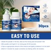 Tooth Filling Repair Kits, Temporary Tooth Repair Kit, for Broken