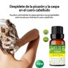 Aceite Esencial De Árbol De Té Antimicotico 100% Natural