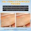Crema Cicatricial De Minimizar Y Reducir Las Cicatrices 20g