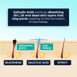 360 CT (10 PK of 36) LivaClean Spot Patches Salicylic Acid - Hydrocolloid Patch, Breakouts Patches, Hydrocolloid Patches, Spot Stickers, Spot Patch, Face Hydrocolloid Patches, Overnight Face Patches